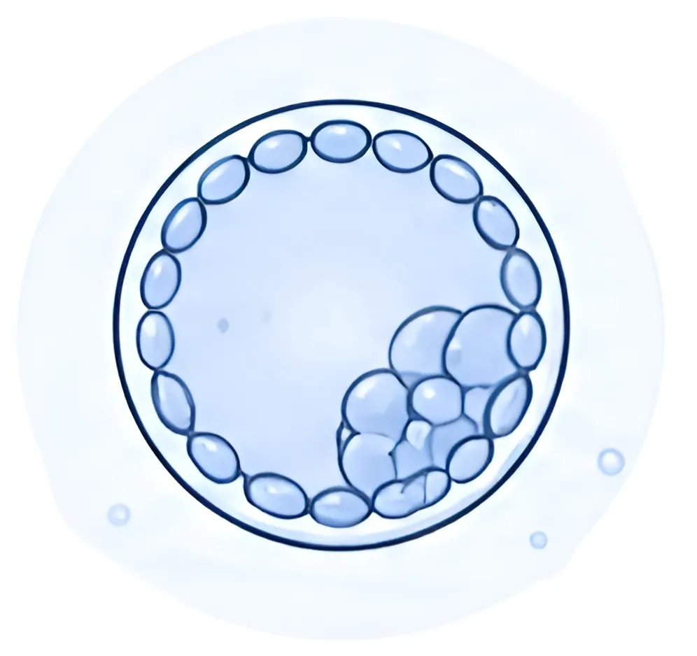Blastocyst Transfer